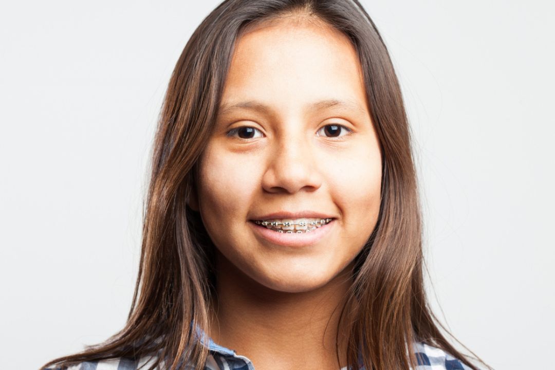 braces for crooked teeth vs gaps comparisonbraces for crooked teeth vs gaps comparison